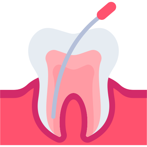 Root Canal Treatment