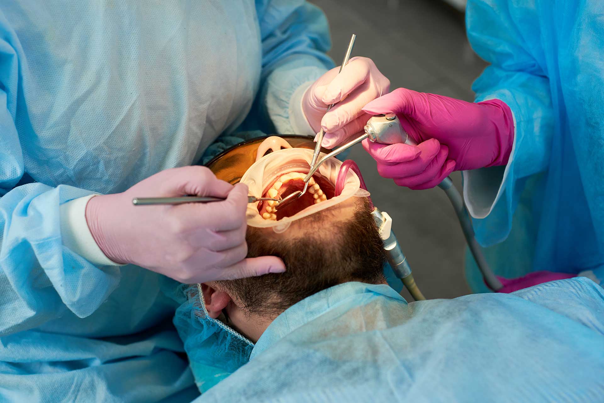 Root Canal Treatment