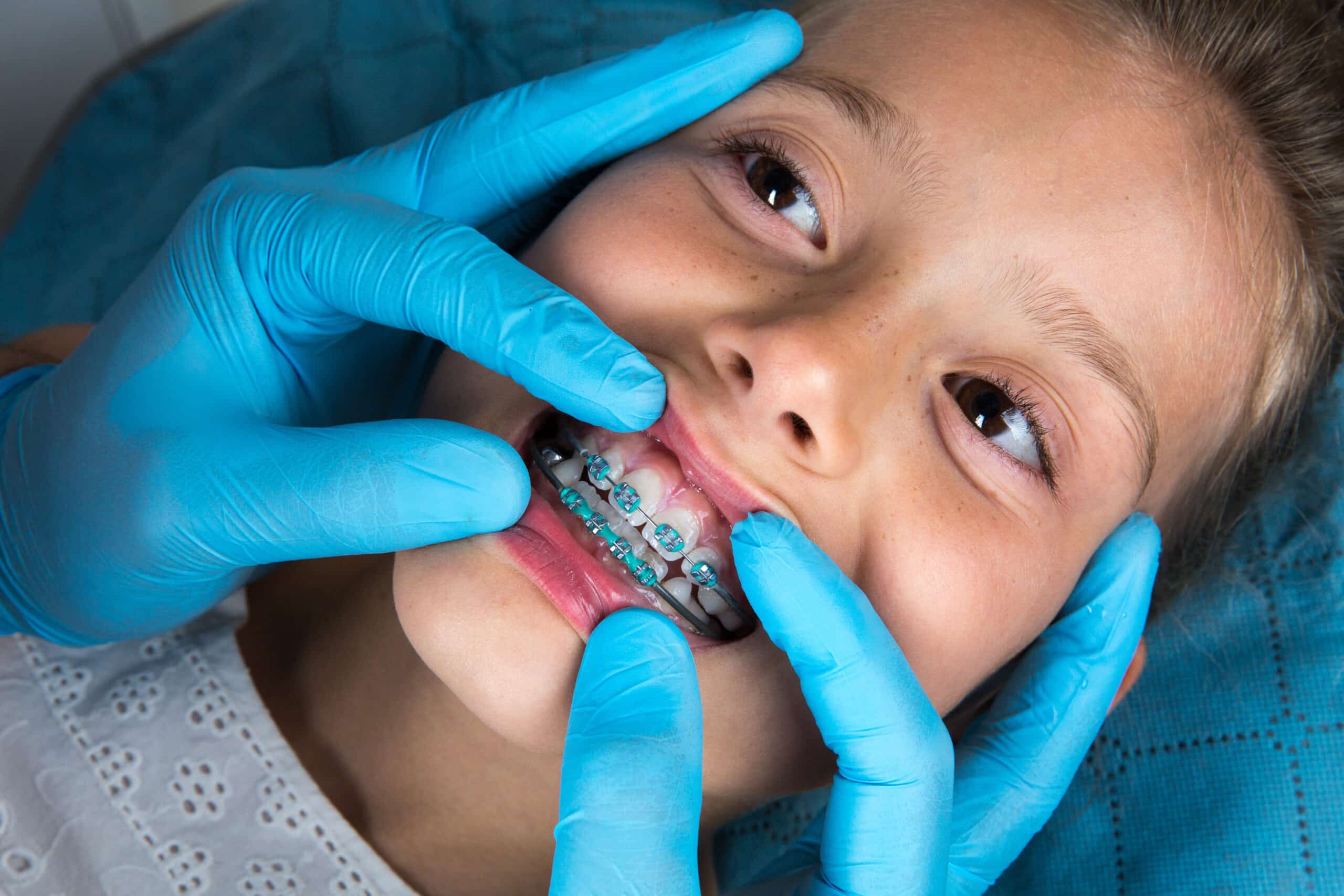 Orthodontic